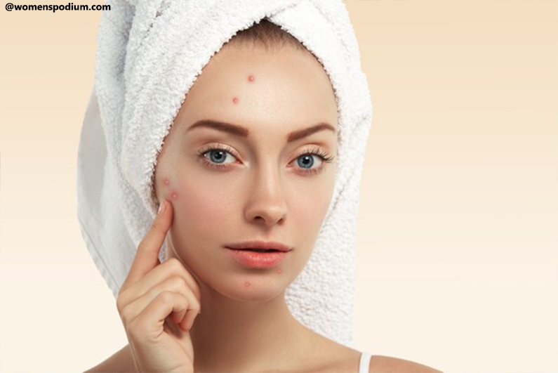 Fewer Acne