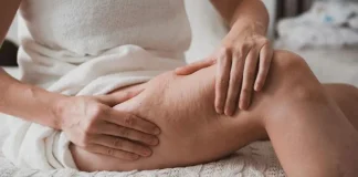 What is Cellulite? How to Get Rid of Cellulite? How to get rid of cellulite