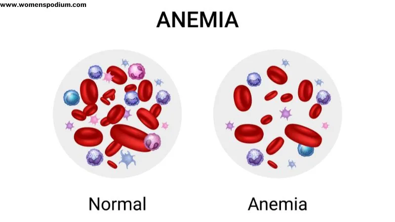 Anemia diet plan