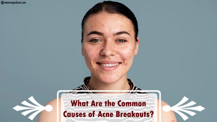 Causes-of-Acne.jpg Causes of Acne