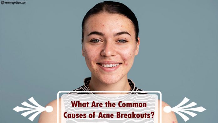 Causes of Acne