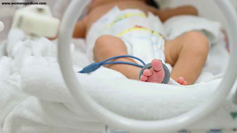 Premature labor and birth - pregnancy complications