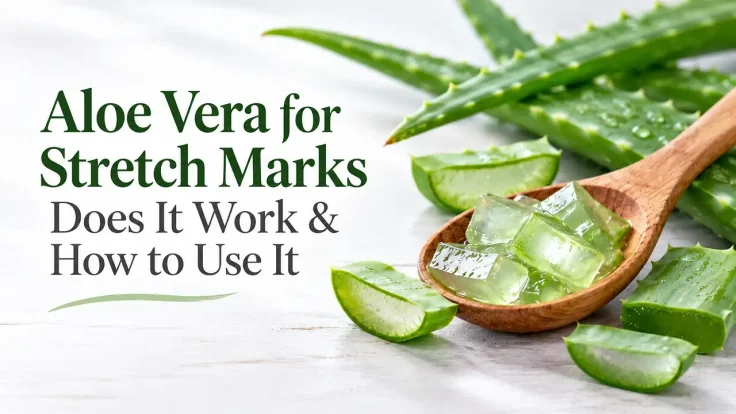 Aloe vera for stretch marks and how to use it