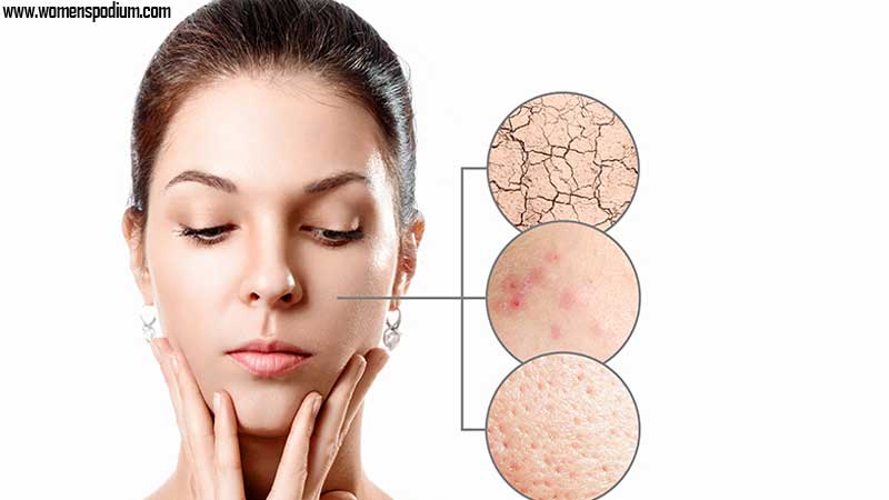 must know your skin type - Dry skin