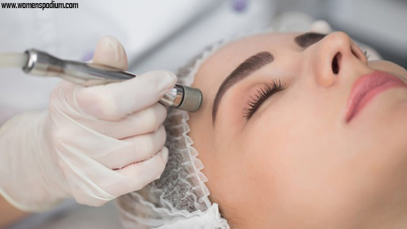 Try Microdermabrasion At Least Once