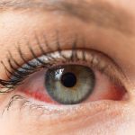Can Dry Eyes Cause Blindness
