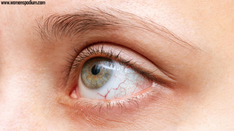 symptoms of dry eye - Can Dry Eyes Cause Blindness
