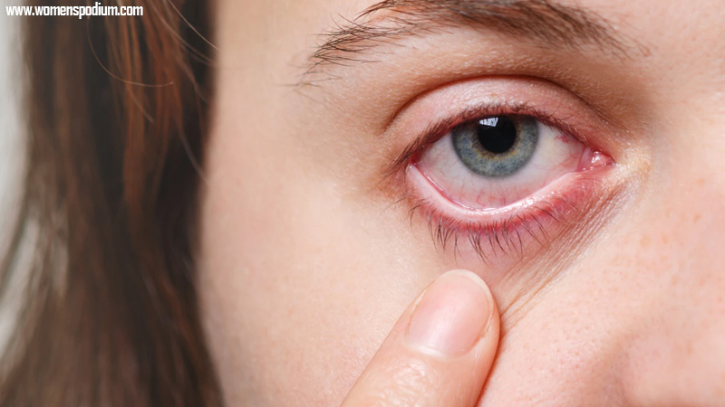 what is dry eye - Can Dry Eyes Cause Blindness