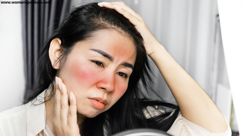 Acne Rosacea