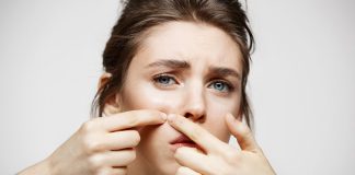 8 Different Types Of Acne – How Can I identify My Acne Type? types of acne