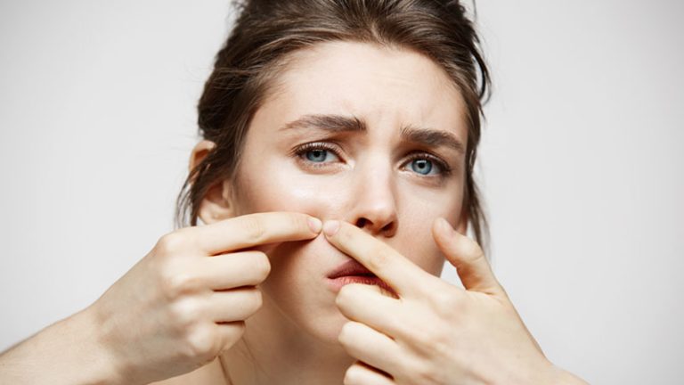 8 Different Types Of Acne – How Can I identify My Acne Type? 8 Different Types Of Acne – How Can I identify My Acne Type?