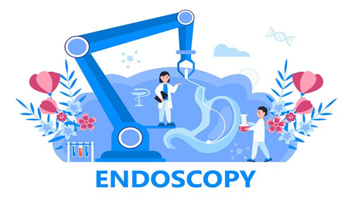 Endoscopy Procedure Preparation