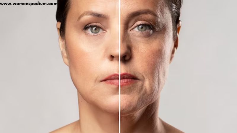 aging skin