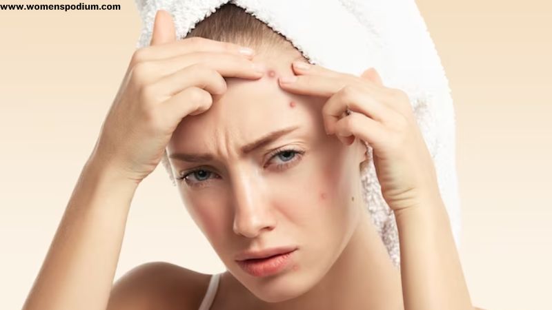 Stress Management and Skin Health glow-up skin